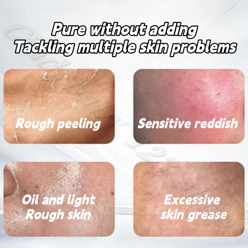 Beauty White Vinegar Essence to Improve Roughness, Fade Melanin, Brighten Skin, Face and Body Available 500ml