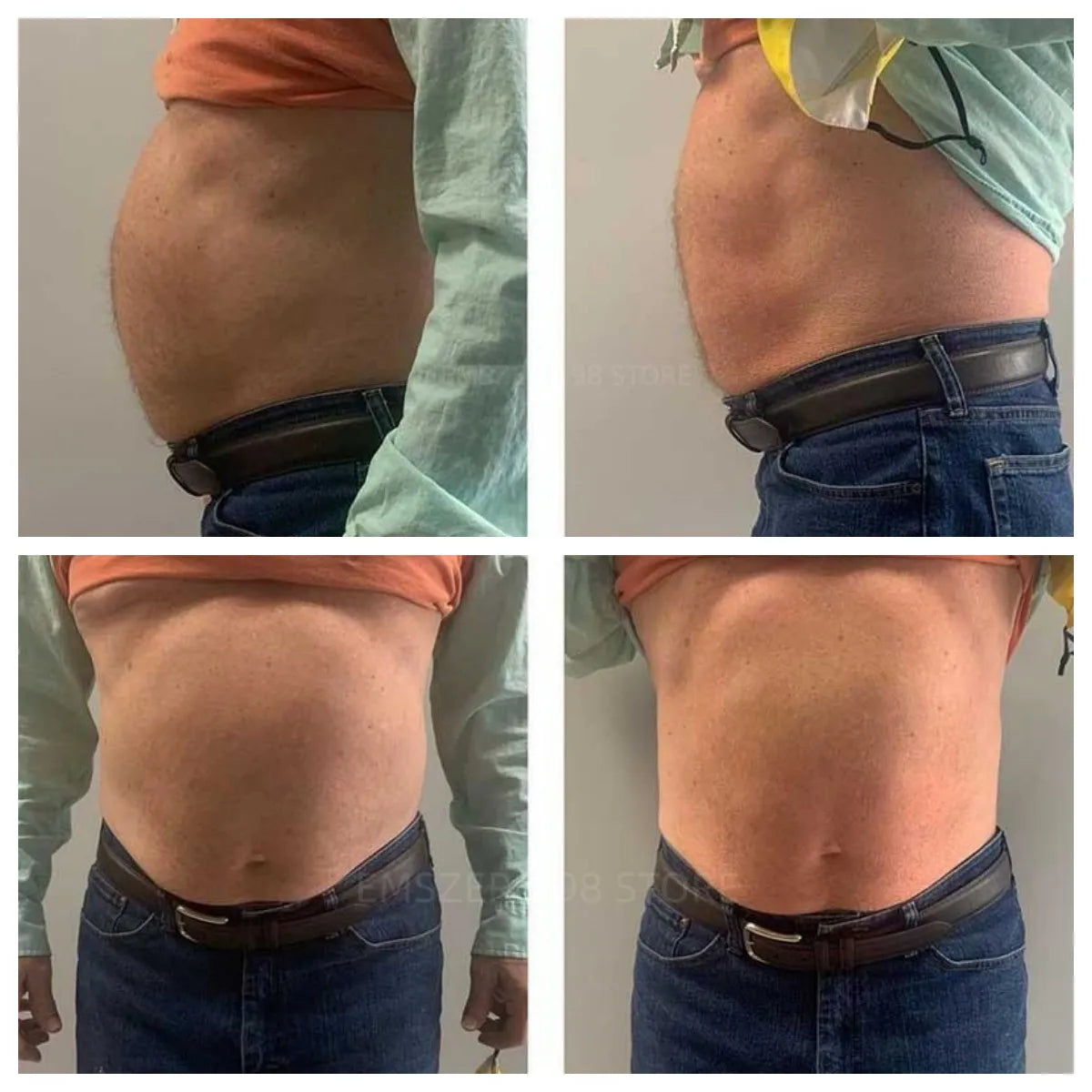 EMSZERO NEO RF HIEMT EMS Body Sculpt Machine Eletric Muscle Stimulator Fat Burner Weight Loss Butt Lifter And Shapers Body Care