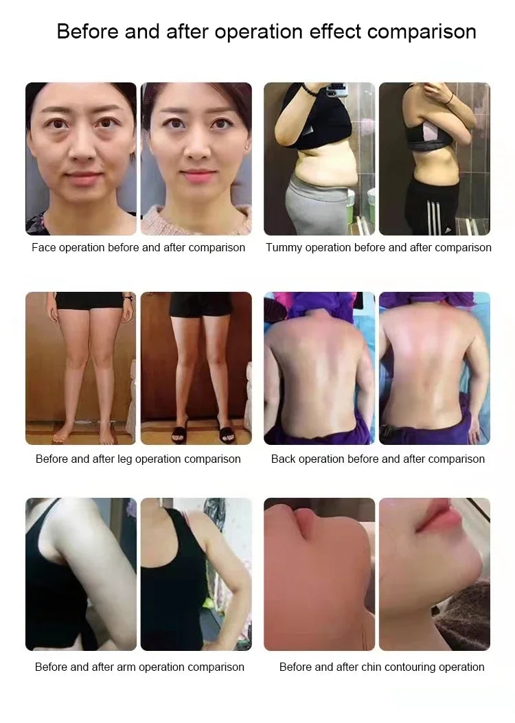 2025new INDIBA Spain Technology 448K Tecar Cavitation Health and Beauty Body Care System RET CET RF Slim Machine for Weight Loss