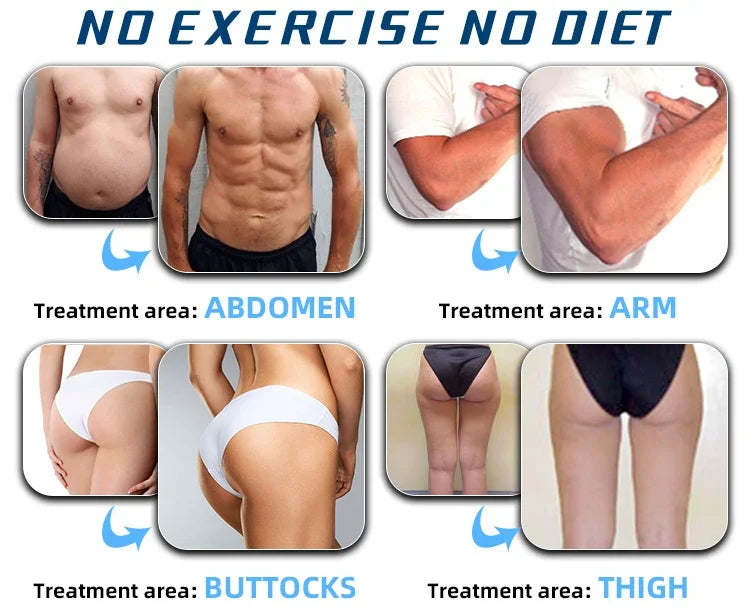 EMSZERO NEO RF HIEMT EMS Body Sculpt Machine Eletric Muscle Stimulator Fat Burner Weight Loss Butt Lifter And Shapers Body Care